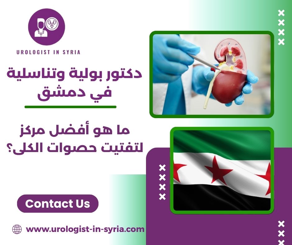 ما هو أفضل مركز لتفتيت حصوات الكلى؟