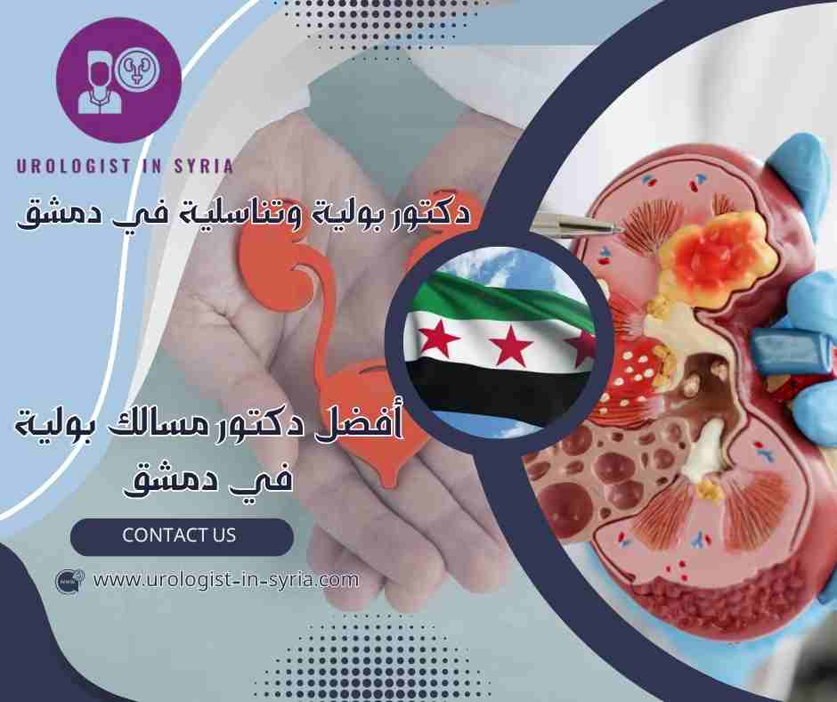 أفضل دكتور مسالك بولية في دمشق