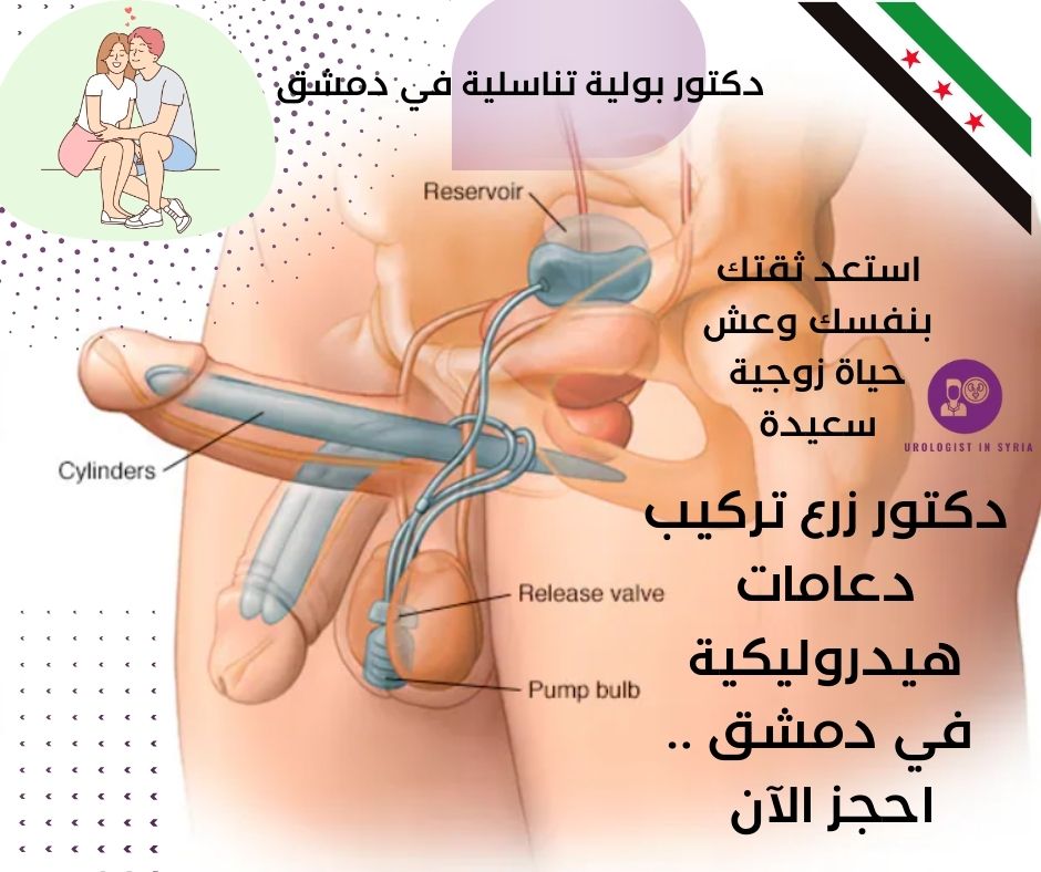 دكتور تركيب دعامة هيدروليك للعضو الذكري في الرياض