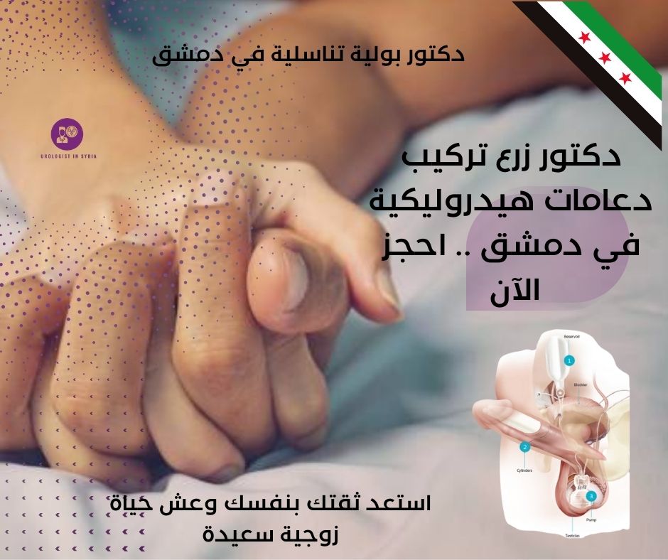 كم تكلفة تركيب دعامة هيدروليكية