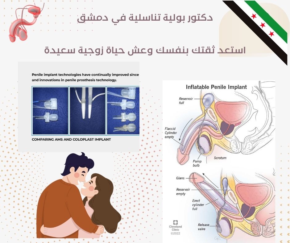تكلفة تركيب دعامة هيدروليك