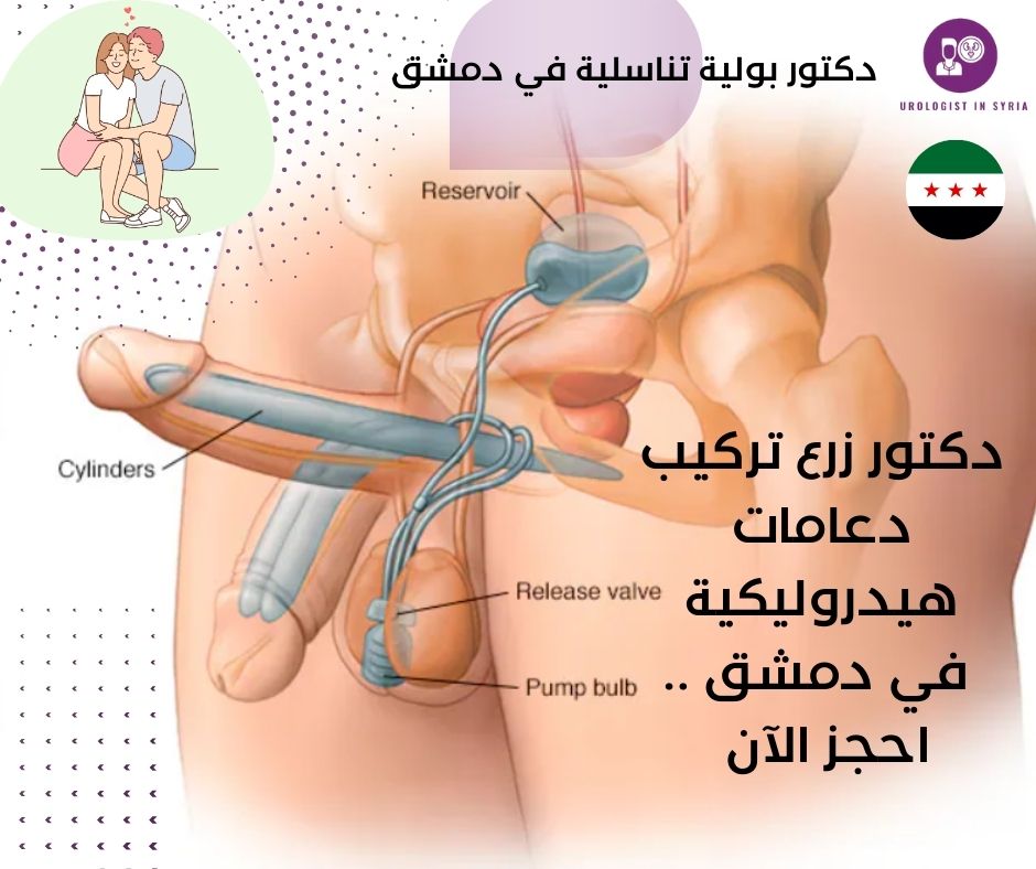 دكتور تركيب دعامات هيدروليكية للعضو الذكري في دمشق 