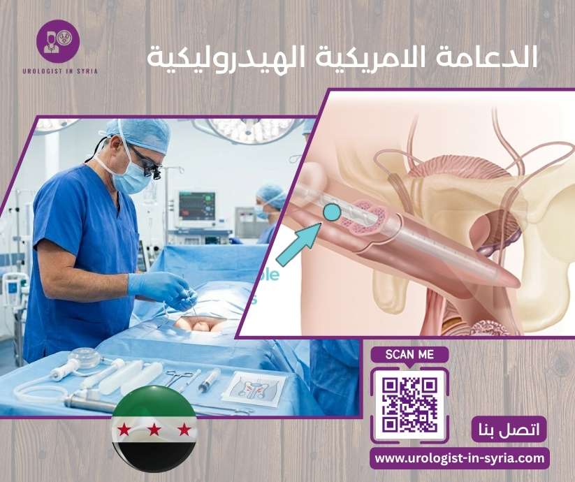 الدعامة الامريكية الهيدروليكية