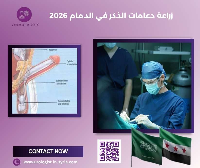 زراعة دعامات الذكر في الدمام 2026