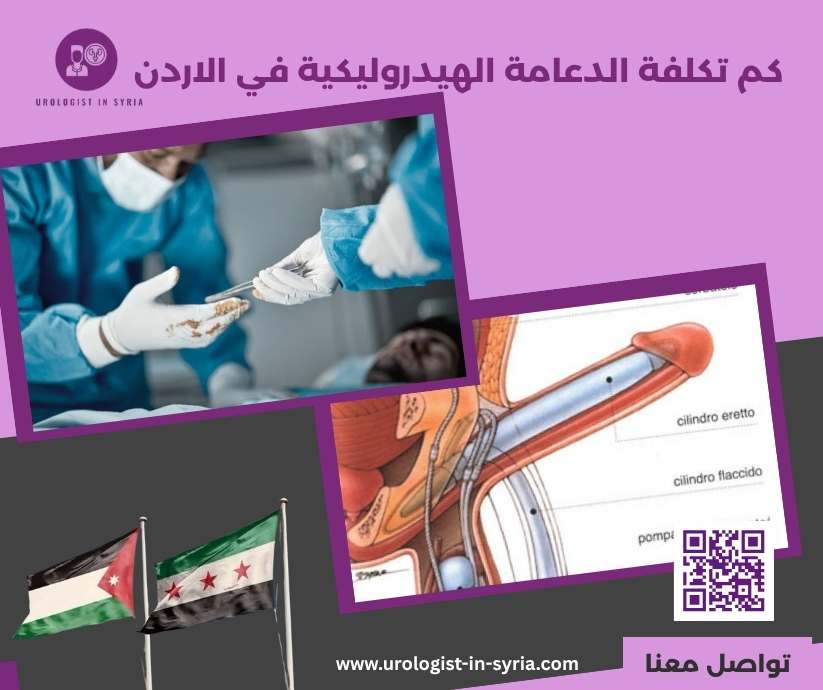 كم تكلفة الدعامة الهيدروليكية في الاردن
