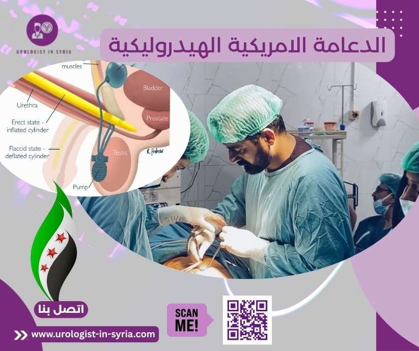 الدعامة الامريكية الهيدروليكية