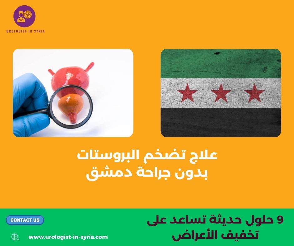 علاج تضخم البروستات بدون جراحة دمشق