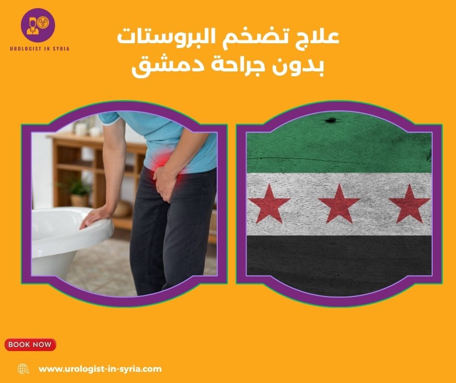 علاج تضخم البروستات بدون جراحة دمشق