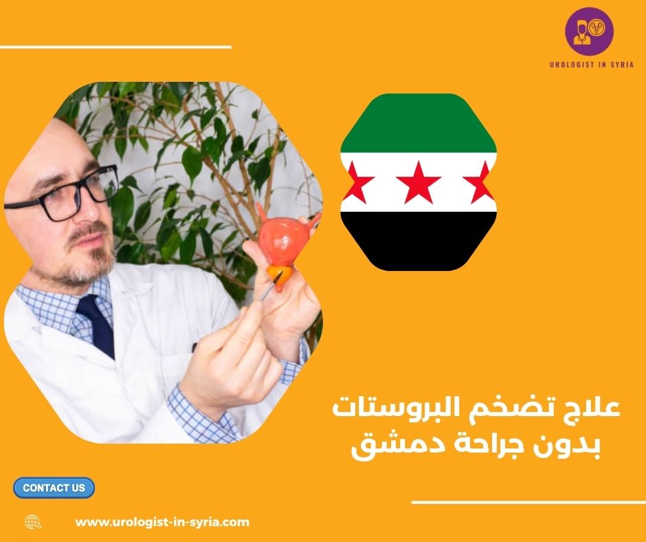 علاج تضخم البروستات بدون جراحة دمشق