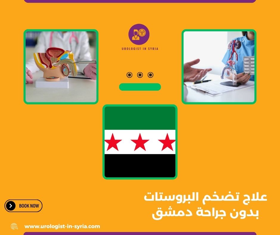 علاج تضخم البروستات بدون جراحة دمشق
