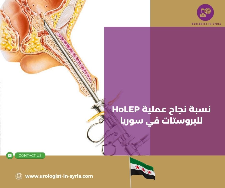 نسبة نجاح عملية HoLEP للبروستات في سوريا