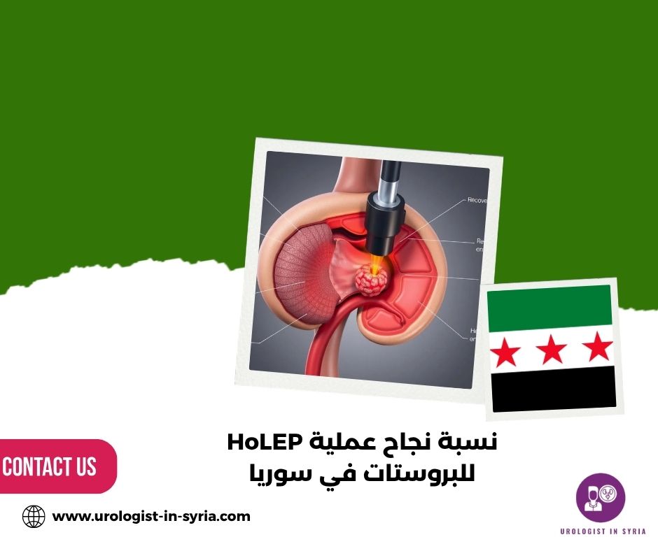 نسبة نجاح عملية HoLEP للبروستات في سوريا