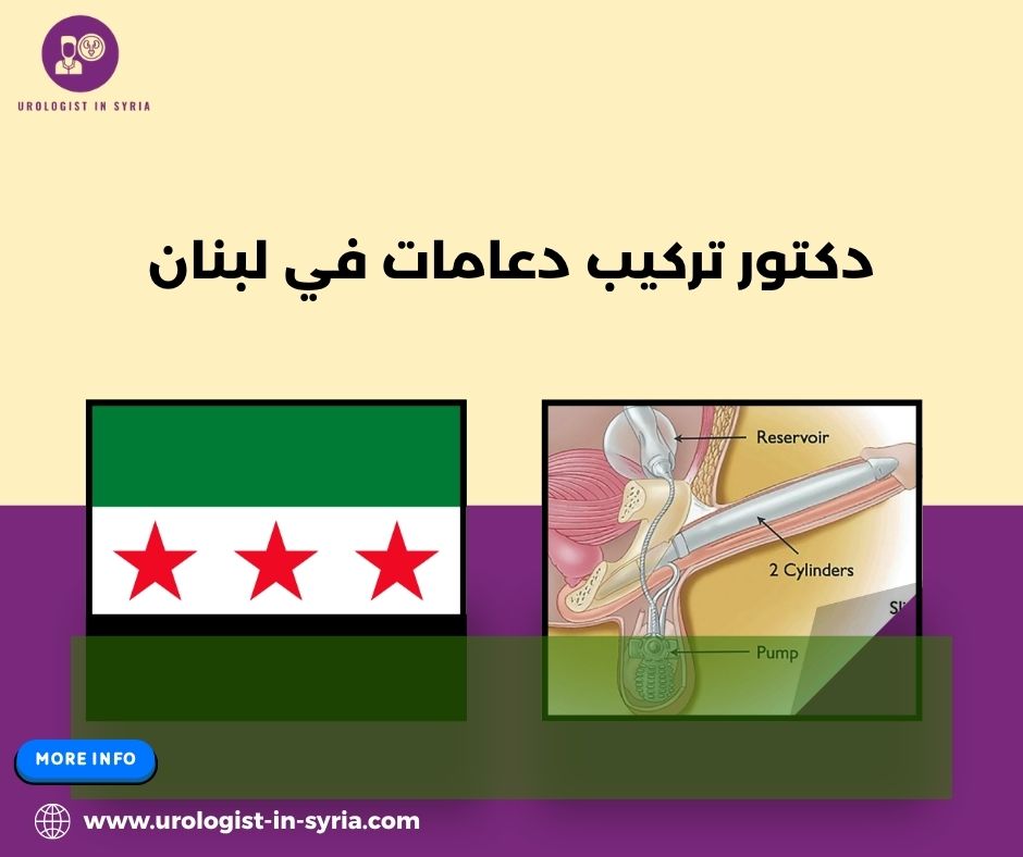 دكتور تركيب دعامات في لبنان دكتور تركيب دعامات في لبنان