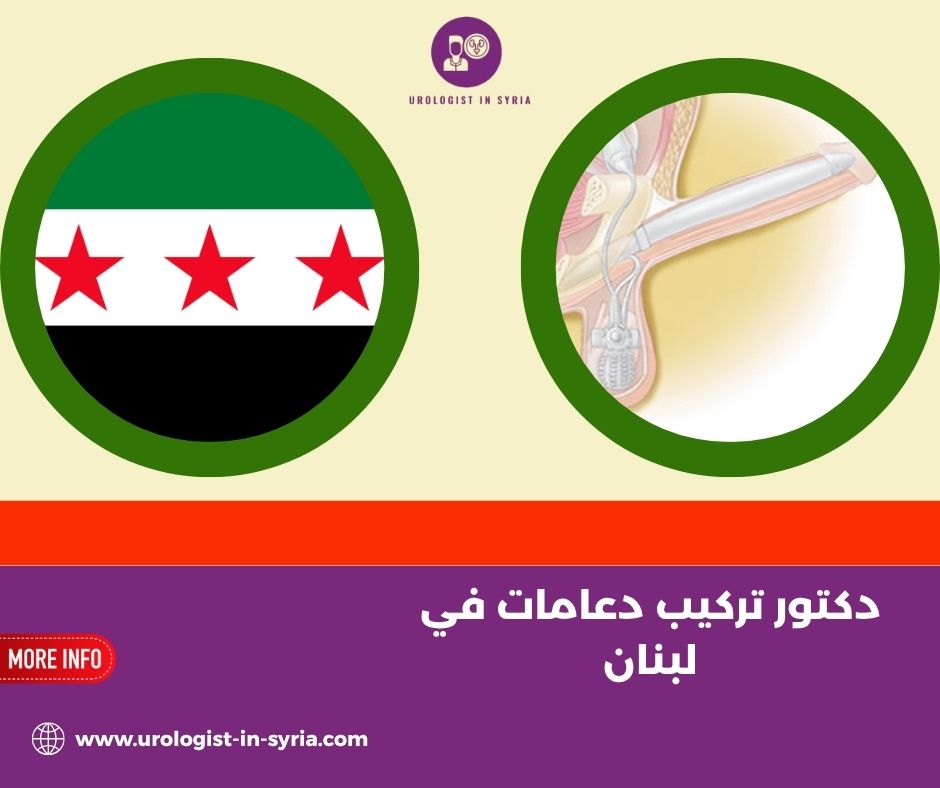 دكتور تركيب دعامات في لبنان دكتور تركيب دعامات في لبنان