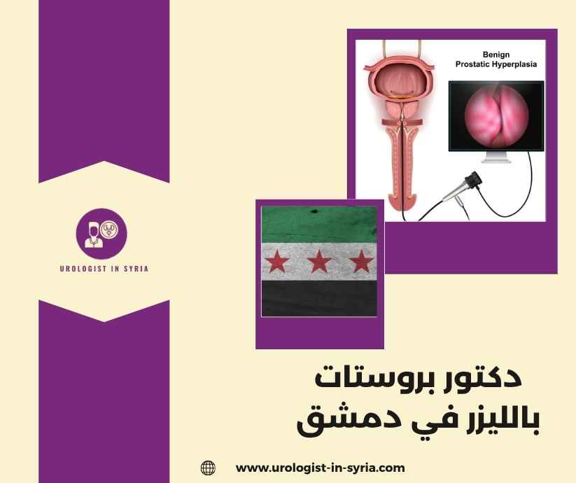 دكتور بروستات بالليزر في دمشق