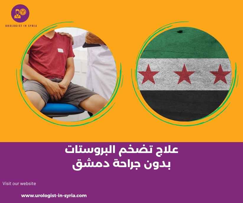 علاج تضخم البروستات بدون جراحة دمشق 