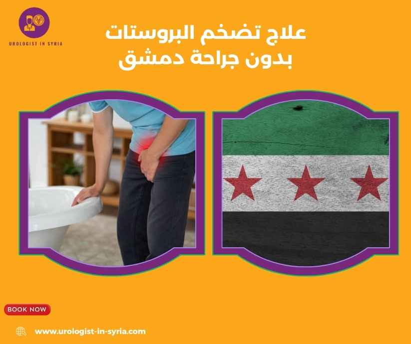 علاج تضخم البروستات بدون جراحة دمشق 