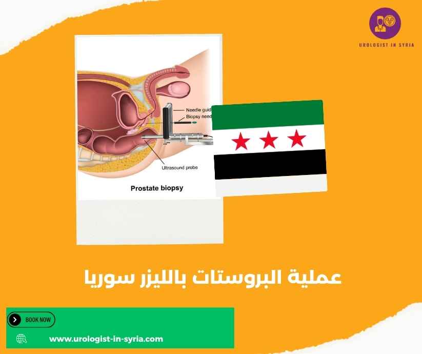 عملية البروستات بالليزر سوريا