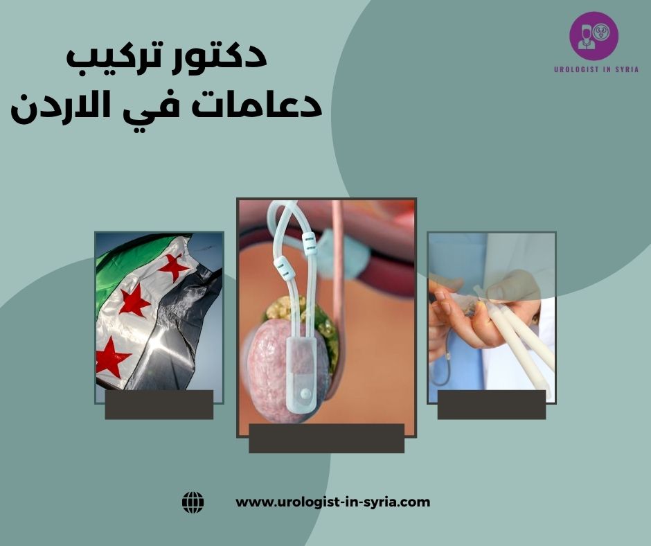 دكتور تركيب دعامات في الاردن دكتور تركيب دعامات في الاردن