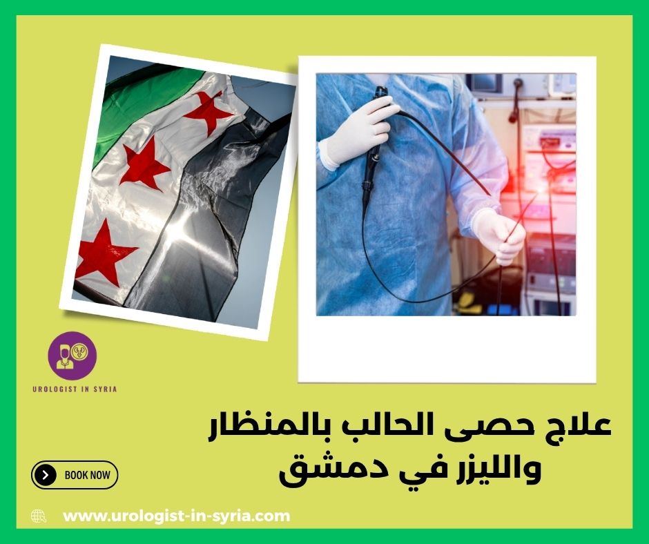 علاج حصى الحالب بالمنظار والليزر في دمشق علاج حصى الحالب بالمنظار والليزر في دمشق