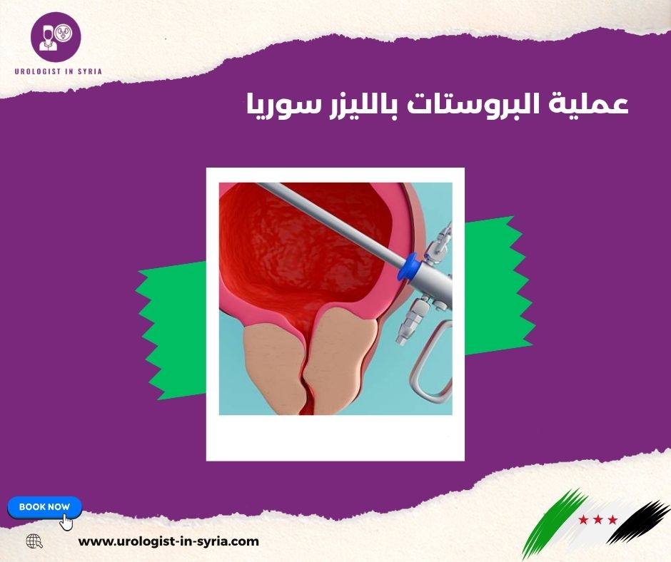عملية البروستات بالليزر سوريا