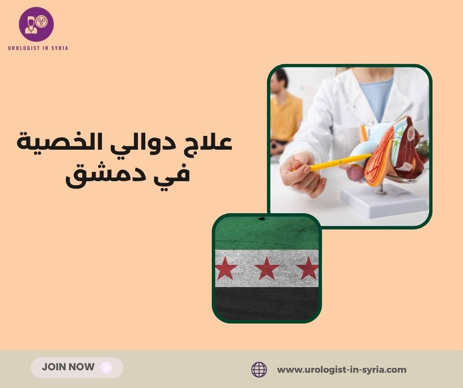 علاج دوالي الخصية في دمشق