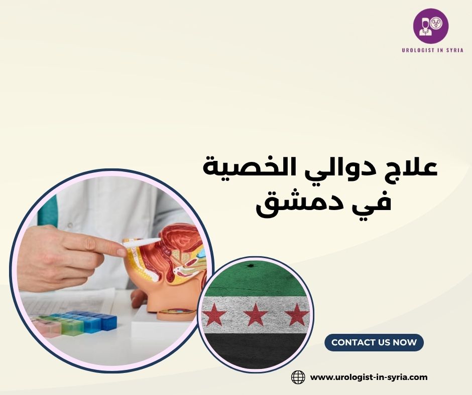 علاج دوالي الخصية في دمشق