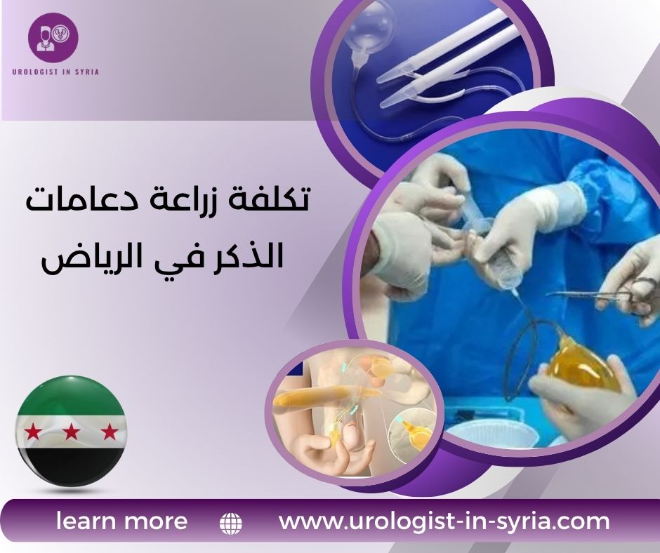 تكلفة زراعة دعامات الذكر في الرياض تكلفة زراعة دعامات الذكر في الرياض
