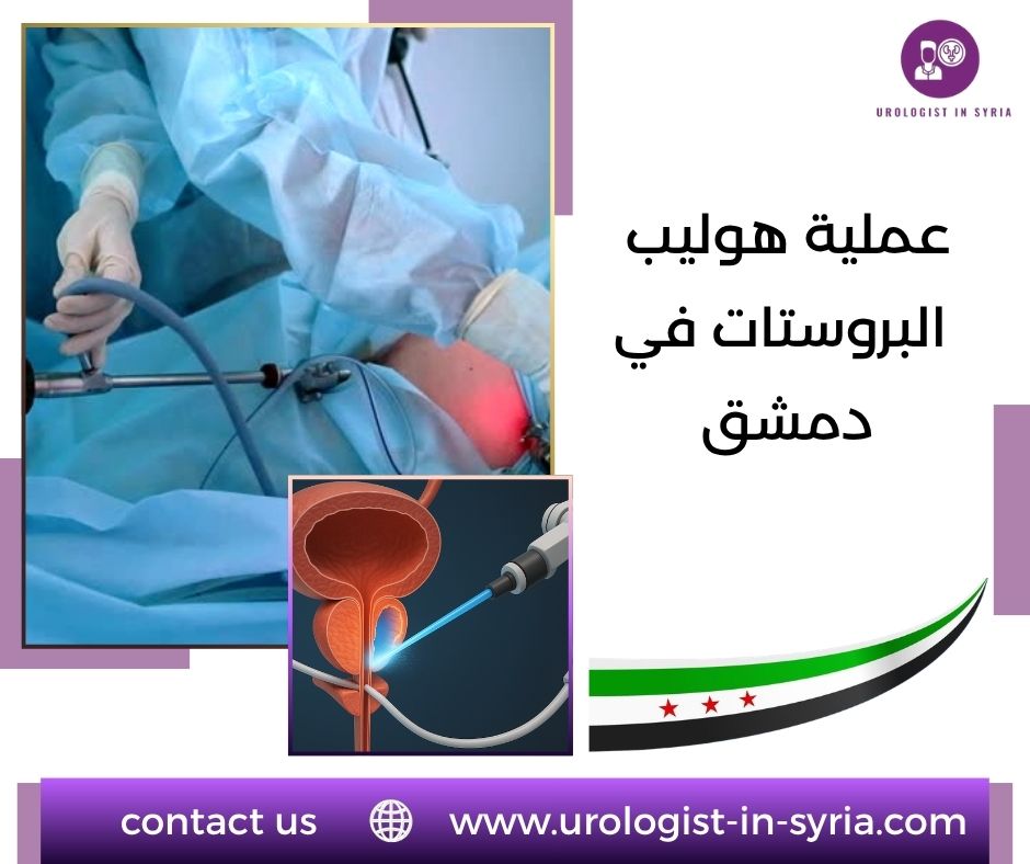 عملية هوليب البروستات في دمشق
