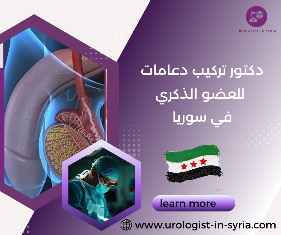 دكتور تركيب دعامات للعضو الذكري دكتور تركيب دعامات للعضو الذكري