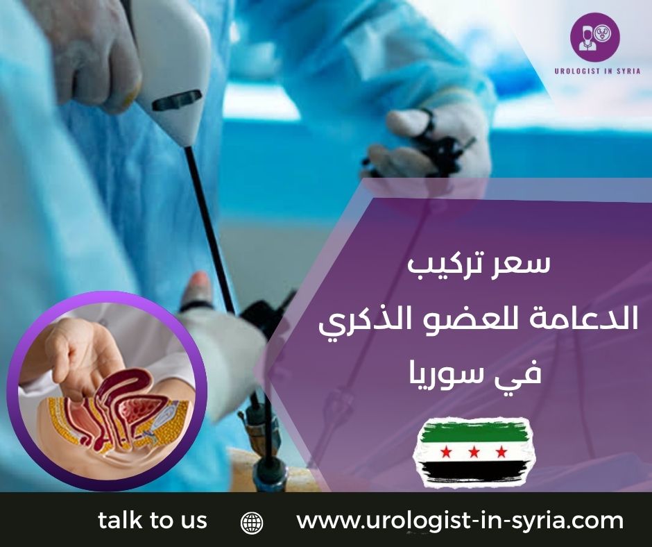 سعر تركيب الدعامة للعضو الذكري في سوريا