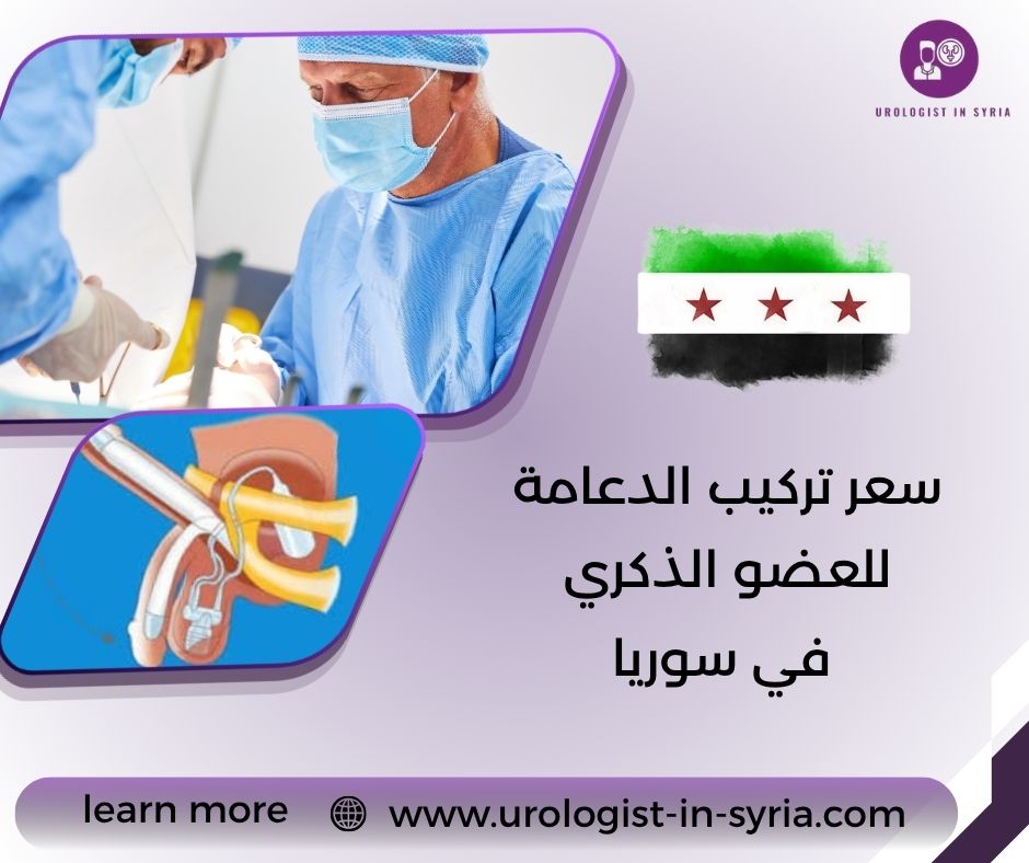 سعر تركيب الدعامة للعضو الذكري في سوريا