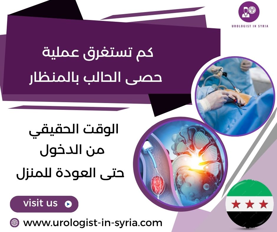كم تستغرق عملية حصى الحالب بالمنظار