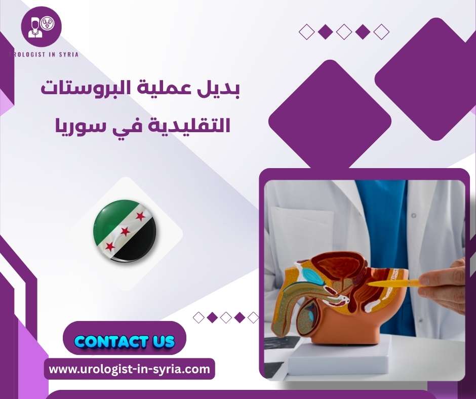 بديل عملية البروستات التقليدية في سوريا 