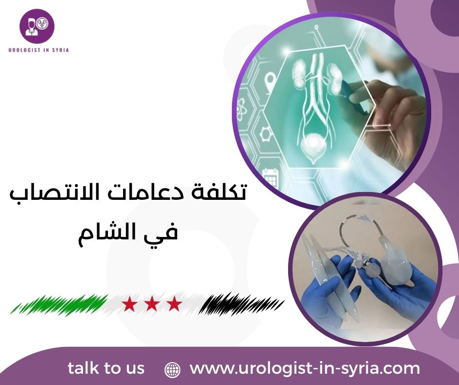 تكلفة دعامات الانتصاب في الشام
