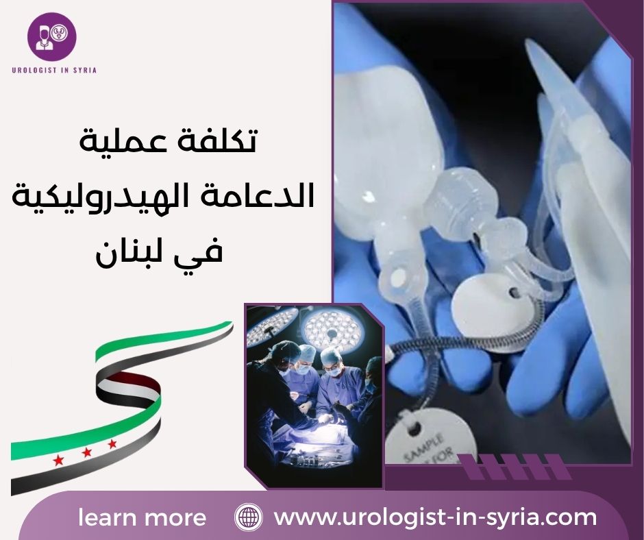 تكلفة عملية الدعامة الهيدروليكية في لبنان تكلفة عملية الدعامة الهيدروليكية في لبنان