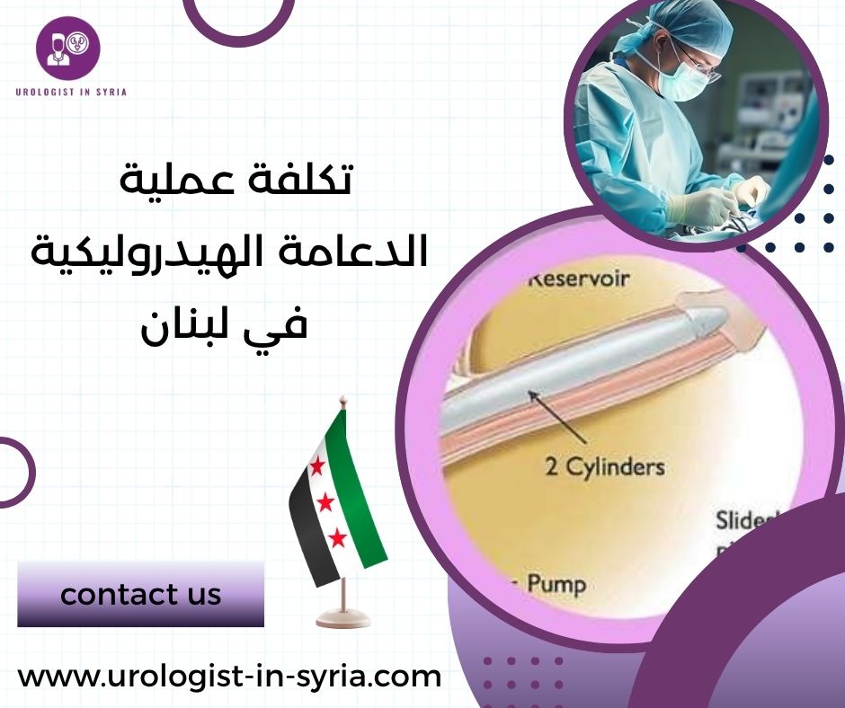 تكلفة عملية الدعامة الهيدروليكية في لبنان تكلفة عملية الدعامة الهيدروليكية في لبنان