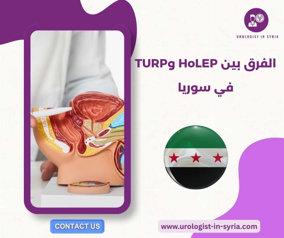 الفرق بين HoLEP وTURP في سوريا