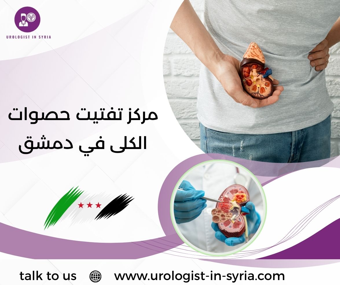 مركز تفتيت حصوات الكلى في دمشق