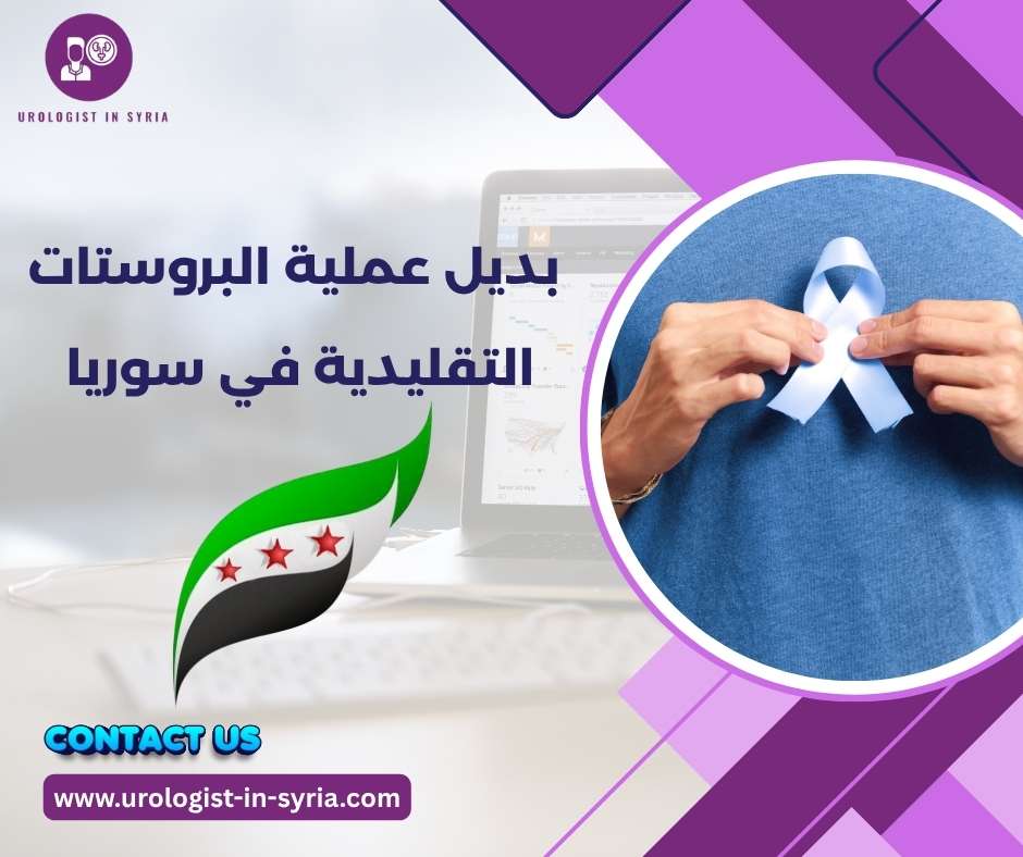 بديل عملية البروستات التقليدية في سوريا 