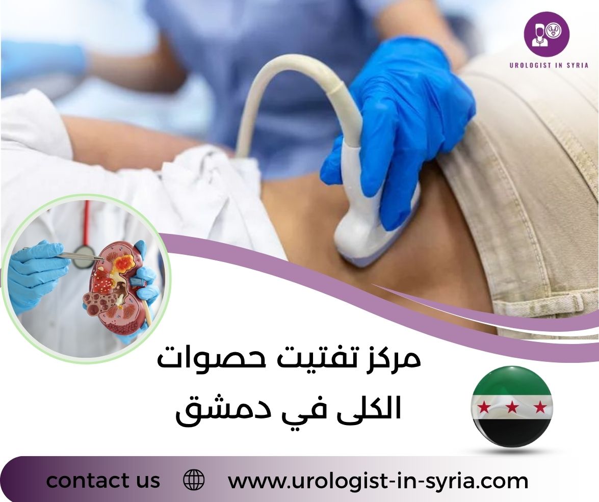 مركز تفتيت حصوات الكلى في دمشق