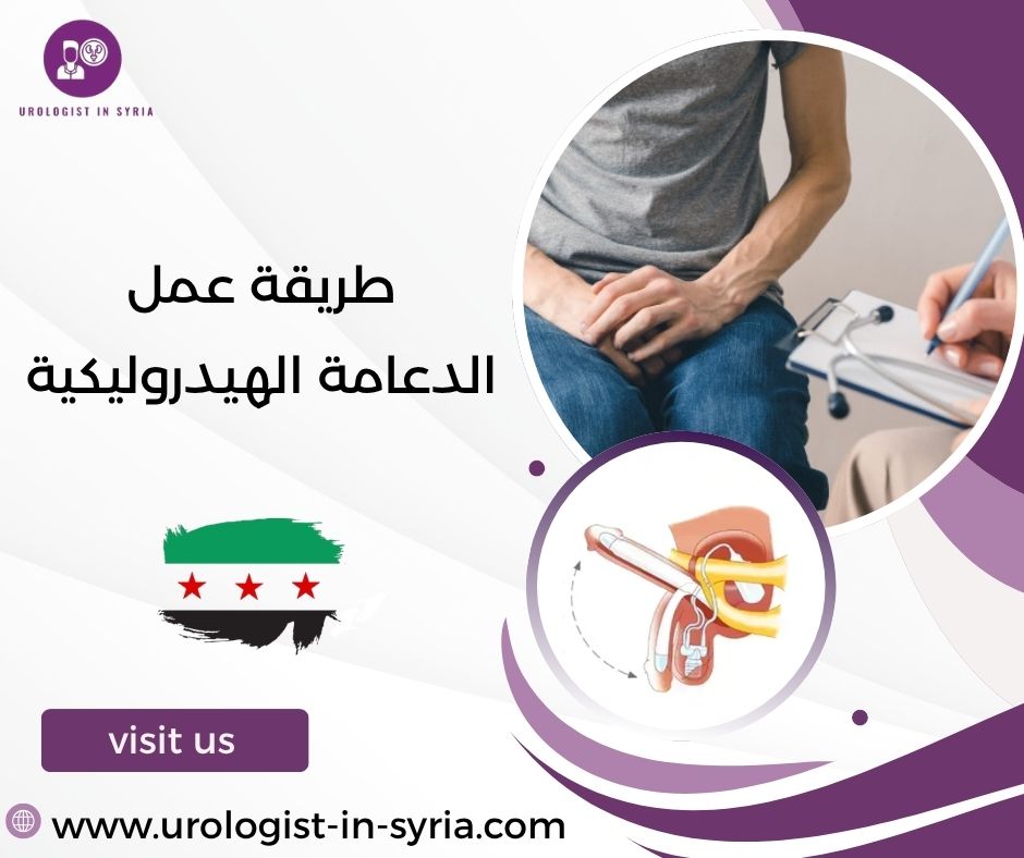 طريقة عمل الدعامة الهيدروليكية طريقة عمل الدعامة الهيدروليكية