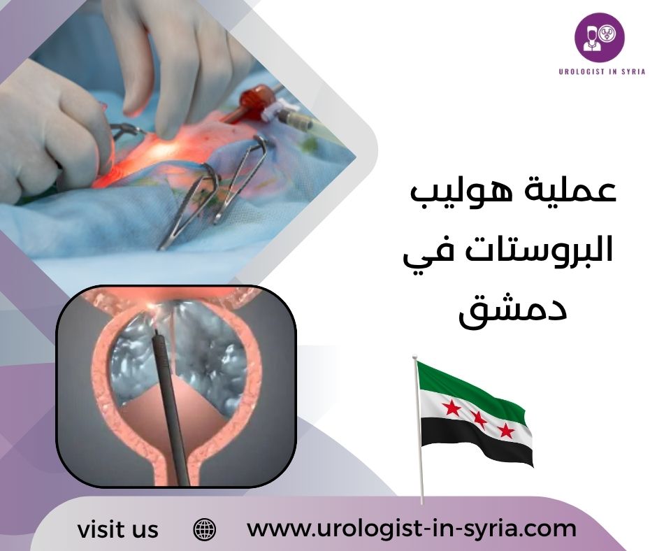 عملية هوليب البروستات في دمشق