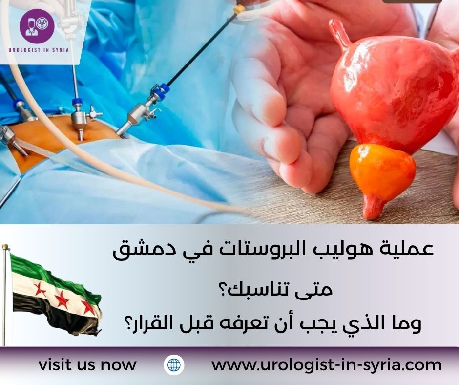 عملية هوليب البروستات في دمشق