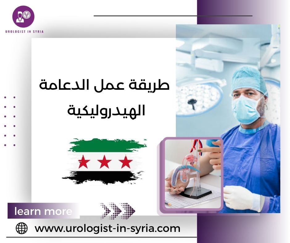 حكم تركيب دعامات للعضو الذكري طريقة عمل الدعامة الهيدروليكية