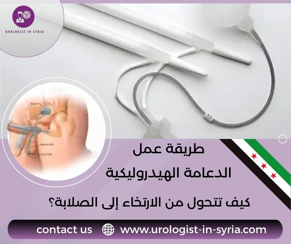 طريقة عمل الدعامة الهيدروليكية