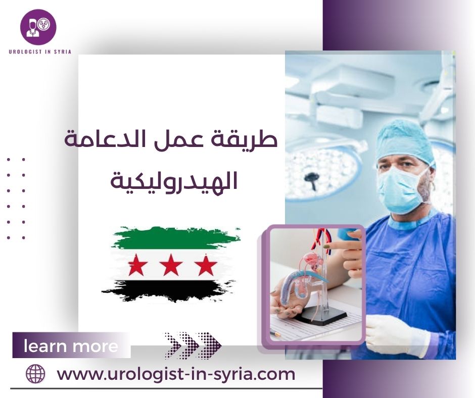 طريقة عمل الدعامة الهيدروليكية طريقة عمل الدعامة الهيدروليكية