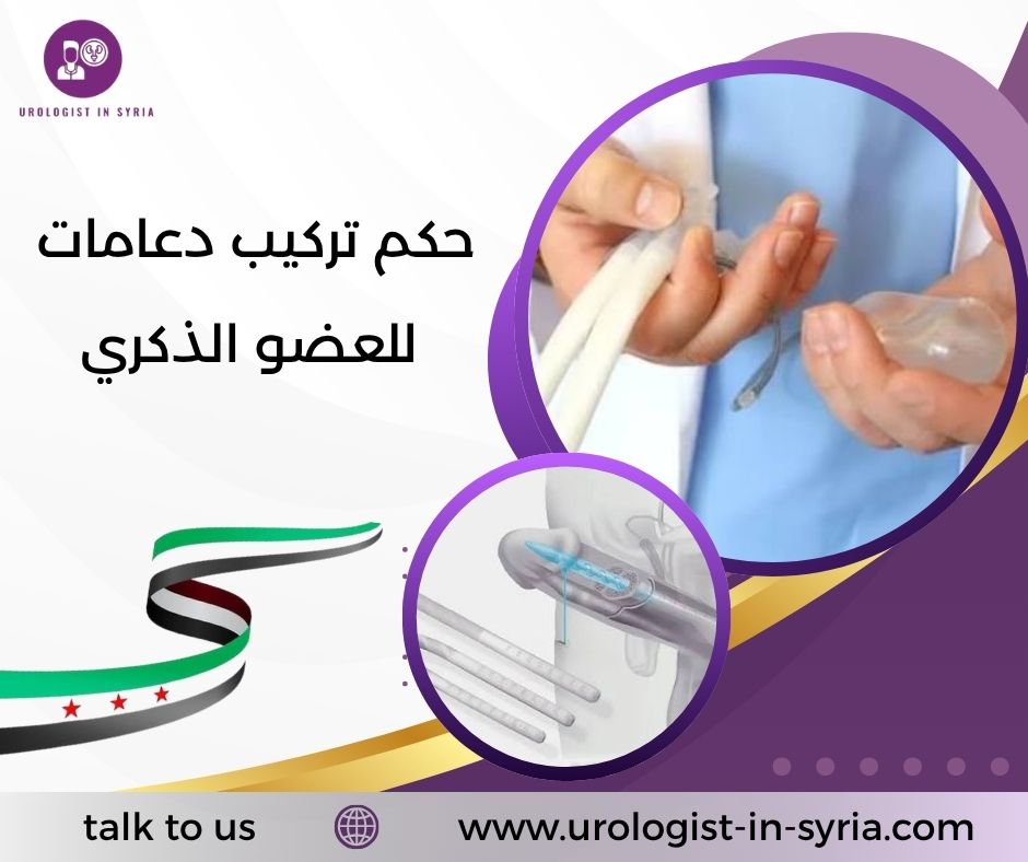حكم تركيب دعامات للعضو الذكري حكم تركيب دعامات للعضو الذكري