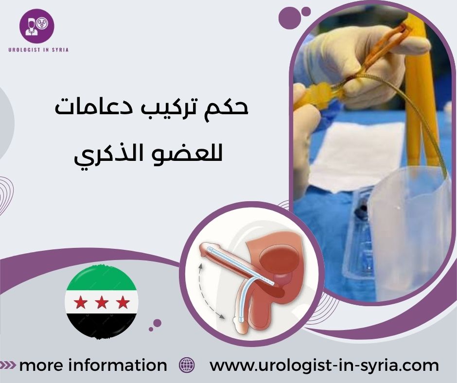 حكم تركيب دعامات للعضو الذكري حكم تركيب دعامات للعضو الذكري