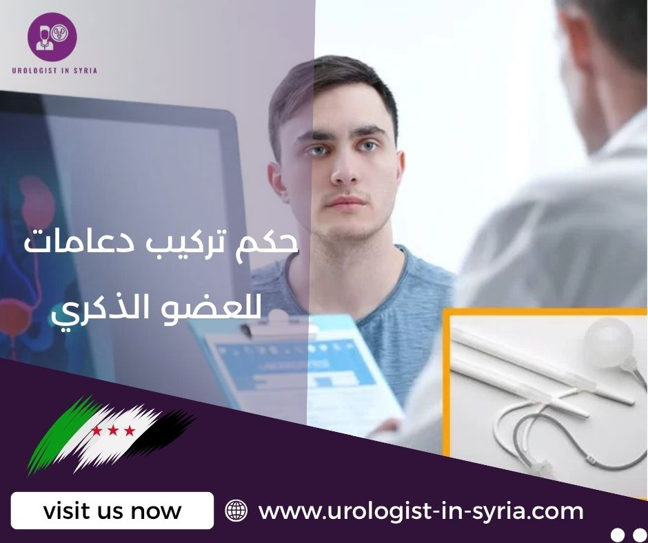 حكم تركيب دعامات للعضو الذكري حكم تركيب دعامات للعضو الذكري